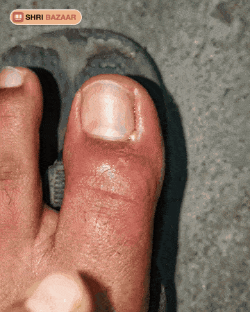 Sore nail edge? Soothing care